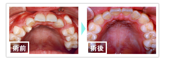 症例1 治療前・治療後